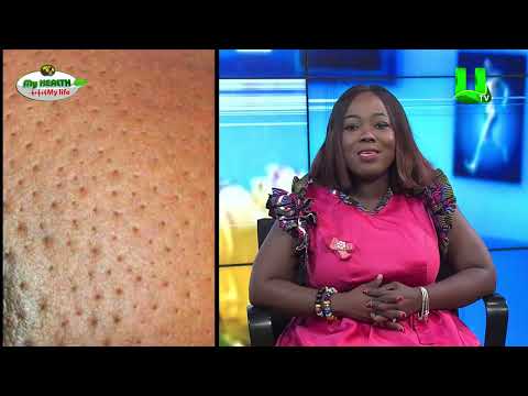 BREAST CANCER AWARENESS: THE ROLE OF RADIOLOGISTS IN EARLY DETECTION AND DIAGNOSIS