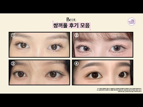 수능 끝나고 쌍수 원했던 공주들을 위한 후기선물세트💖🎁