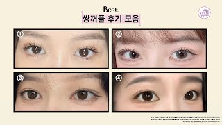 수능 끝나고 쌍수 후기선물세트💖🎁