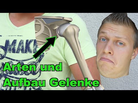 Zervikalen Osteochondrose Symptome und Behandlung Gymnastik Bewegung nach der Operation am Hüftgelenk