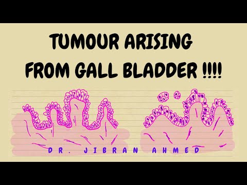RHEUMATOID ARTHRITIS II BONES AND SOFT TISSUE II ARTHRITIS II ROBBINS 10TH E II PATHOLOGY LECTURES