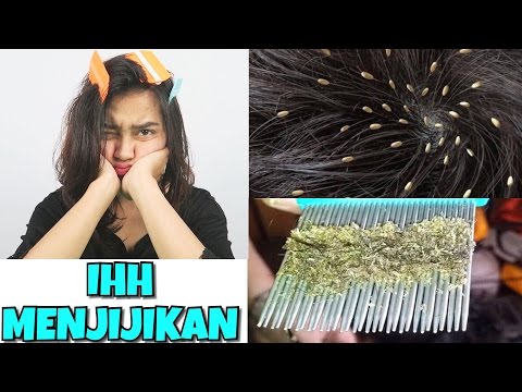 Tetes untuk ulasan onetwoslim penurunan berat badan di Minsk Saya kehilangan berat badan dengan berpuasa