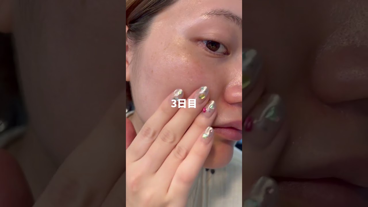 バズり中の針美容液でガチ検証📝してみた結果...!! #カタン #美容 #カタンダーマヒットセラム #スキンケア #shorts