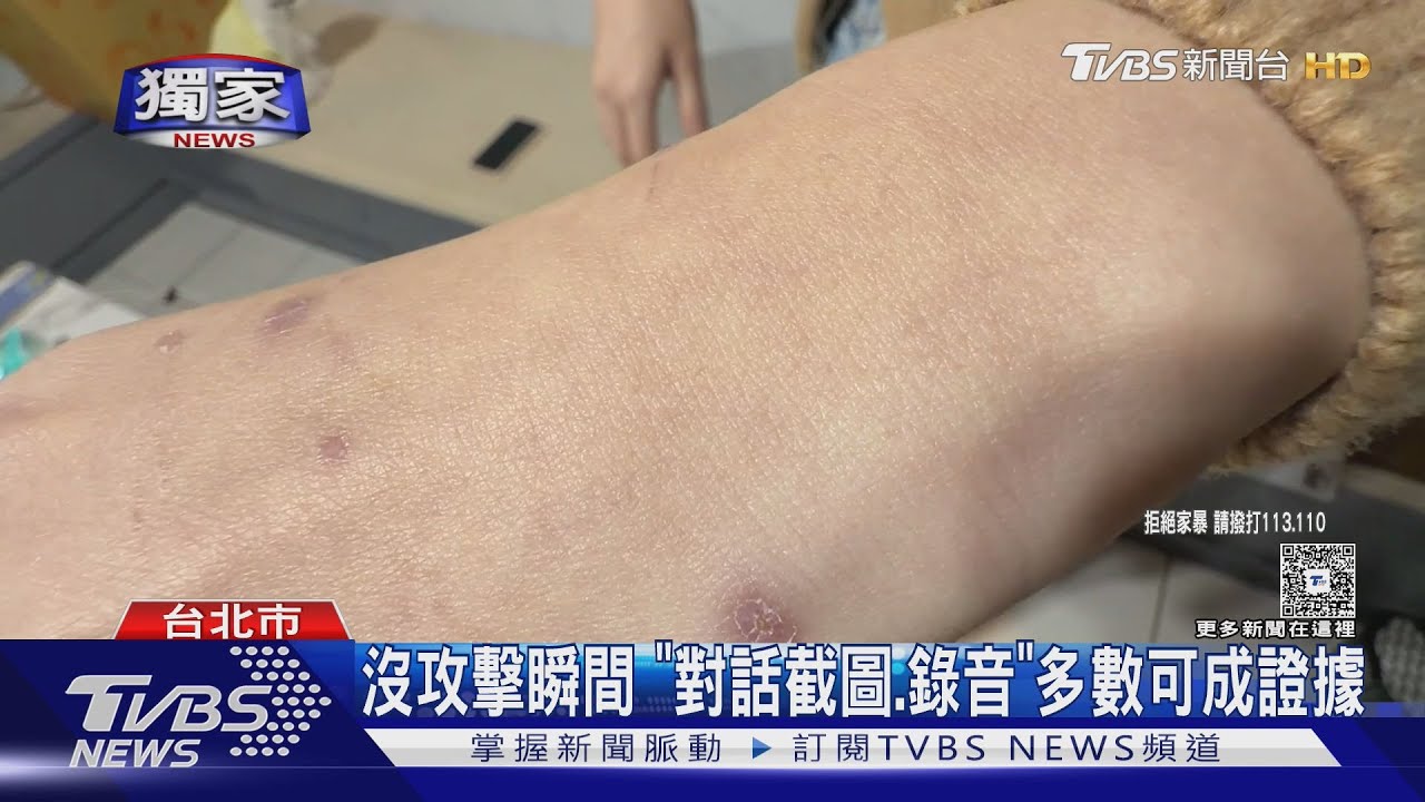 獨/女控遭家暴拍「指痕、瘀青」蒐證 法界提醒1舉動恐觸法