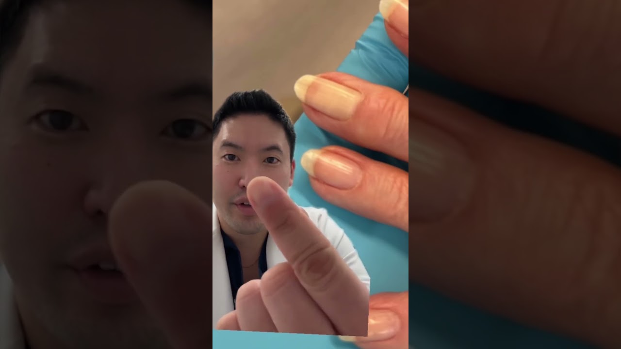 Nail Abnormalities that May Worry Your Dermatologist