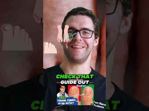 Skin Tag Removal Wart Removal How To Get Rid Of Skin Tags Warts