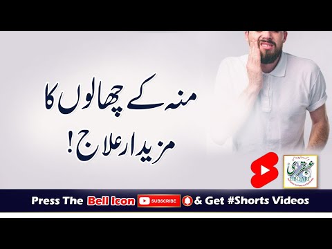 Moun Ke Chalon Ka Mazedar Ilaj