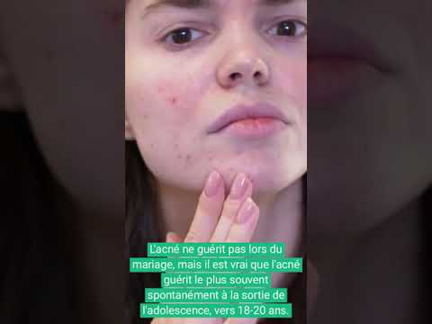 Vidéo : mécanisme de l'acné