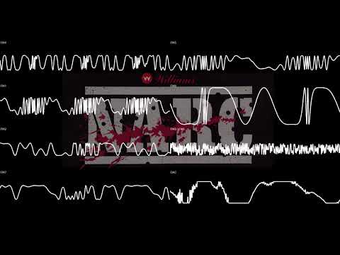 NARC - The "Stick" (Arcade)