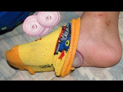 download lagu mp3 mp4 Onions In Socks, download lagu Onions In Socks gratis, unduh video klip Onions In Socks