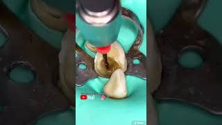 ¡Le mataron el nervio al diente!