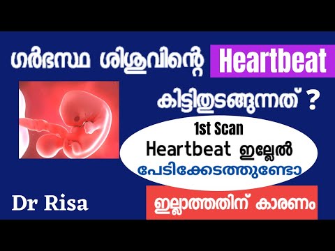 Positive Pregnancy But No Fetal Heartbeat Malayalam | fetal heartbeat start at