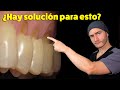 Wedge Shaped Wear At The Neck Of The Teeth Cause And Solution Dental Abfraction