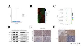 TIPE2 inhibits melanoma progression through MEK/ERK signaling