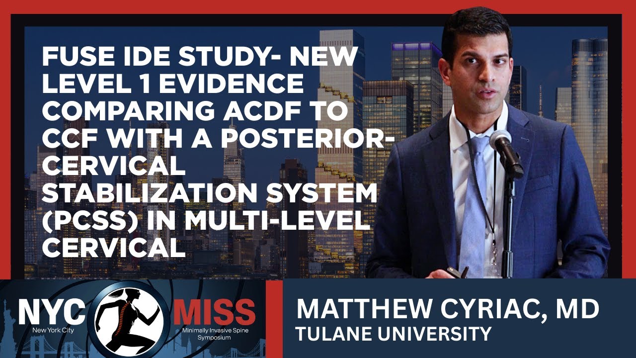 FUSE IDE Study: New Level 1 Evidence Comparing ACDF to CCF - Matthew Cyriac, M.D.