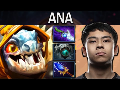 Slark Dota 2 Gameplay Ana with 27 Kills and Skadi