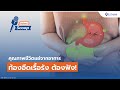 อาการ
