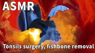 Cave perspective is back! Tonsils surgery, fluorescent fish bone removal, black-hearted clinic