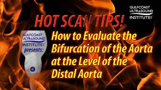 Hot Tip-How to Evaluate the Bifurcation of the Aorta at the Level of the Distal Aorta