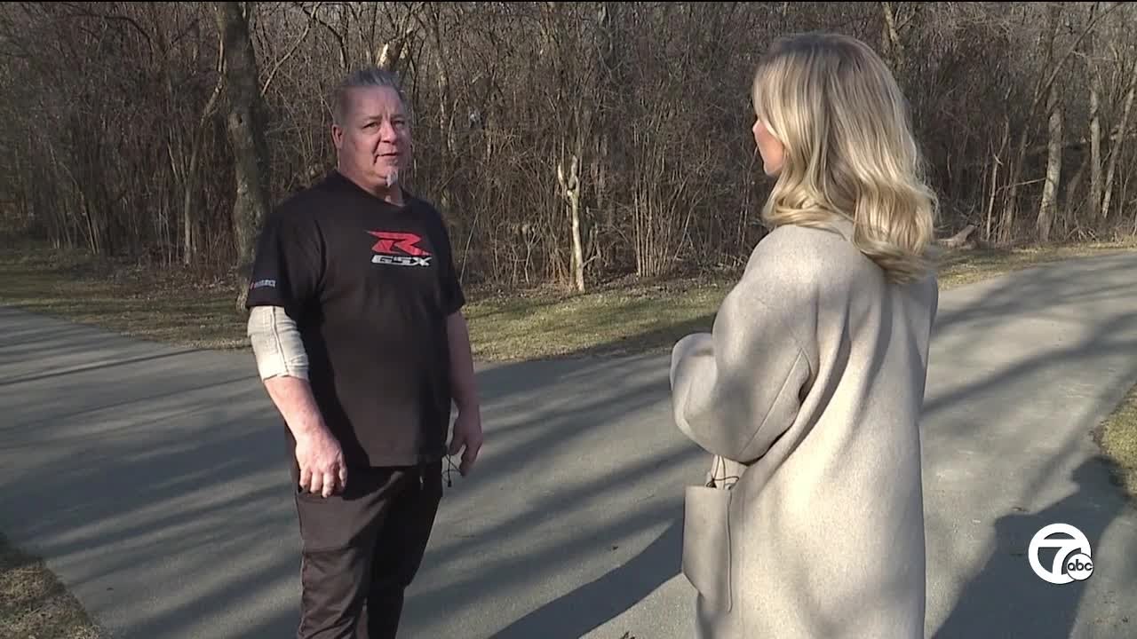 'I got 20 stitches': Dog bites man at Sterling Heights park, police looking for owners