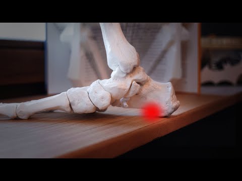 Plantarfasziitis - 7 Dinge, die wirklich helfen