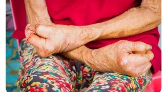 National leprosy programme part 2