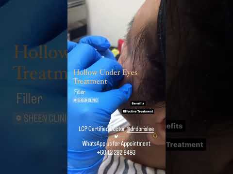 Restylane Tear Trough Filler