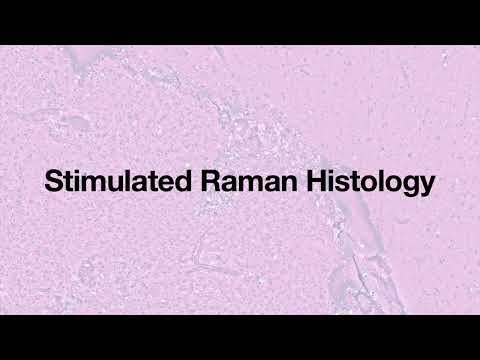 OpenSRH: optimizing brain tumor surgery using intraoperative stimulated Raman histology - watch on YouTube