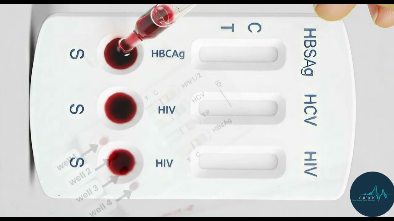 Watch: How to Use an At-Home STD Test Kit