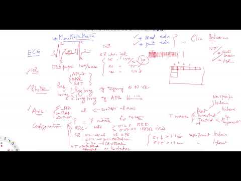 ^MuniSTHealth - #202 How To Read An ECG?