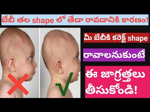 Flat head prevention &care - head shape in baby - head shape correct position baby - flat head syndrome -