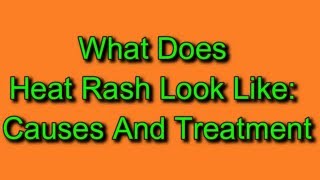 What Does Heat Rash Look Like: Causes And Treatment