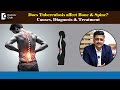 Bone Tuberculosis And Lumbar Spondylosis Wear And Tear Of Lower Back Explained Backpain Dr Mohan MR