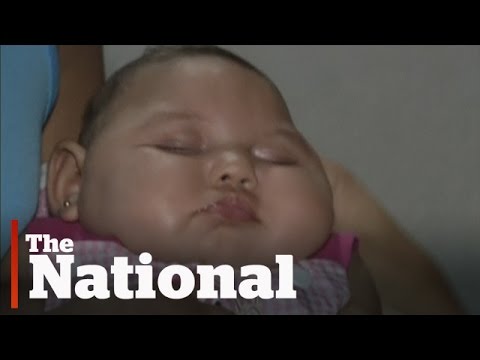 Zika Virus Concerns Spreading Around the World