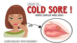 Cold sores or Fever blisters - Small painful blisters on lips ! #herpes #blisters