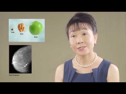 The Importance of Cancer Screening - Dr Sue Lo
