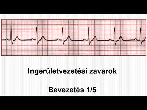 az ecg változása magas vérnyomásban