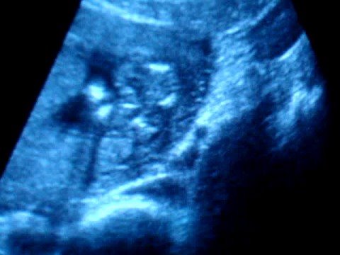 Targa sul trattamento del collo Una serie di esercizi nella colonna toracica in osteocondrosi