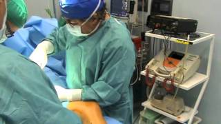 Come si svolge l&#39;intervento CHIVA