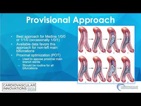 Algorithmic approach to bifurcations - Jason Wollmuth, MD