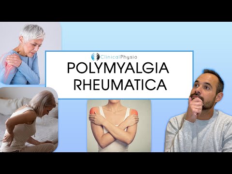 Polymyalgia Rheumatica | Signs and Symptoms of PMR