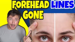 Say Goodbye to Forehead Lines FOREVER