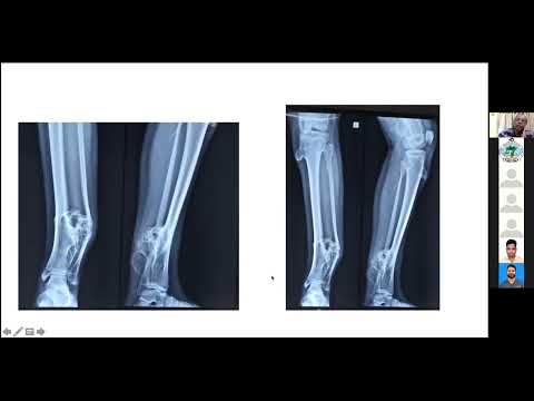 Video 6