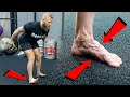 Must Do Foot Strength Exercises For Athletes