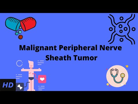Malignant Peripheral Nerve Sheath Tumor Causes Signs and Symptoms Diagnosis and Treatment