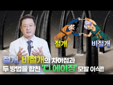 심각한 탈모도 구제 가능한 '대량 모발 이식' 디 에이징에 대해 알아보자!