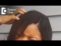 Reasons for itchy scalp and how to treat it - Dr. Rasya Dixit