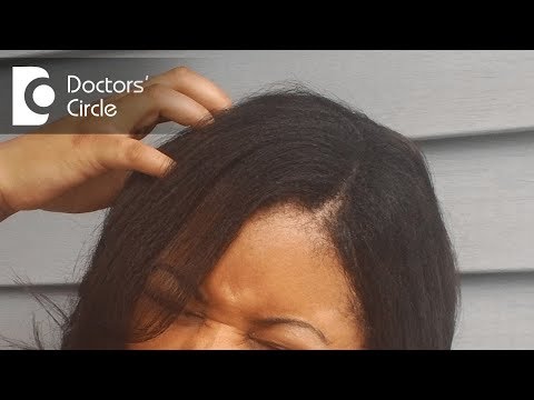 Plaque psoriasis scalp removal
