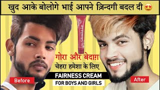 Grazia Up Skin Whitening Cream Review | Dark Private Part, Dark Elbow, Dark Neck...