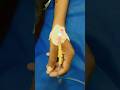 Hospital Sad Status Video Viralvideo Shorts Hospital
